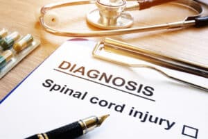 Spinal Cord Injury Compensation: Pursuing Maximum Damages in Broward County
